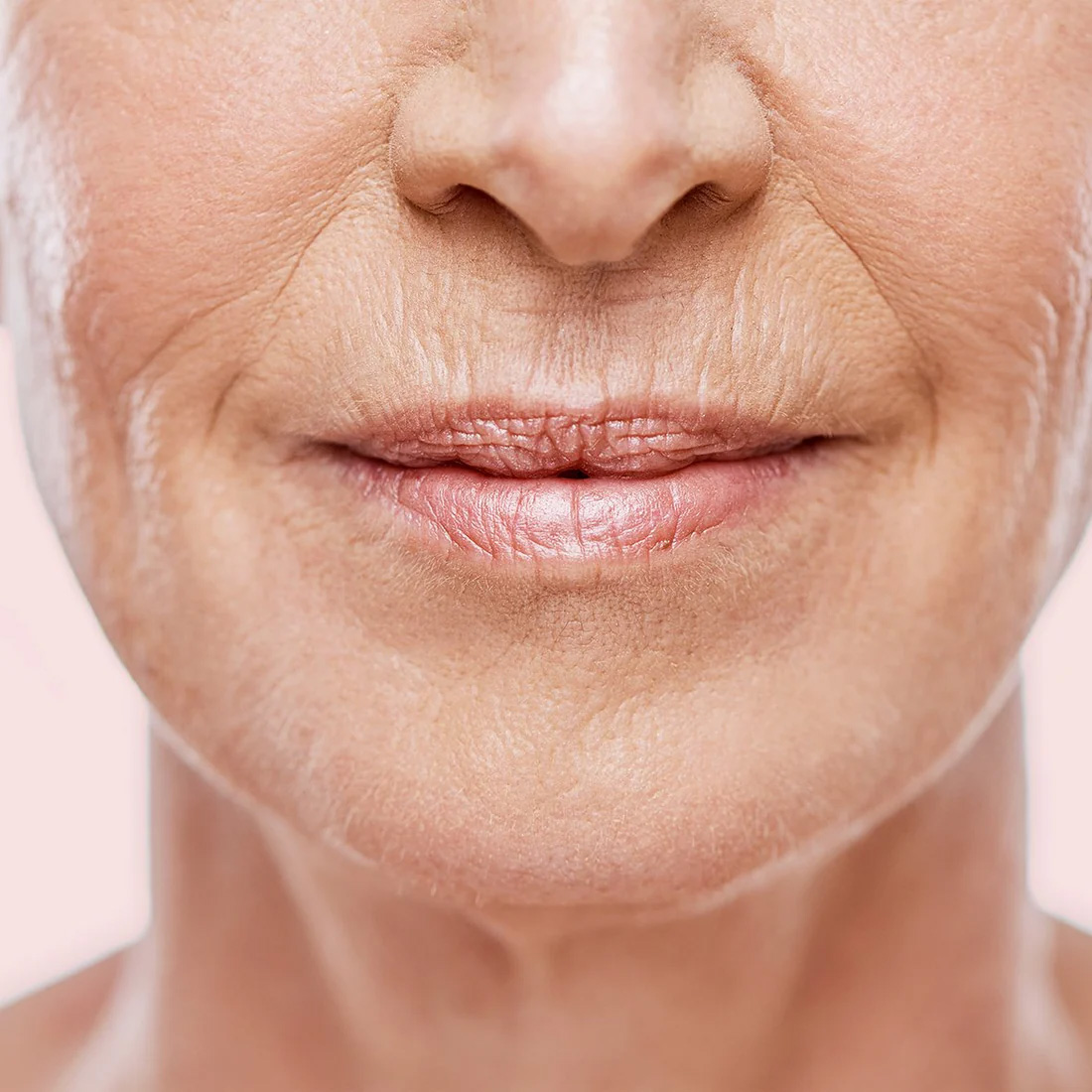 faltenbehandlung laser Falten und feine Linien mit dem Laser behandeln lassen in Zofingen