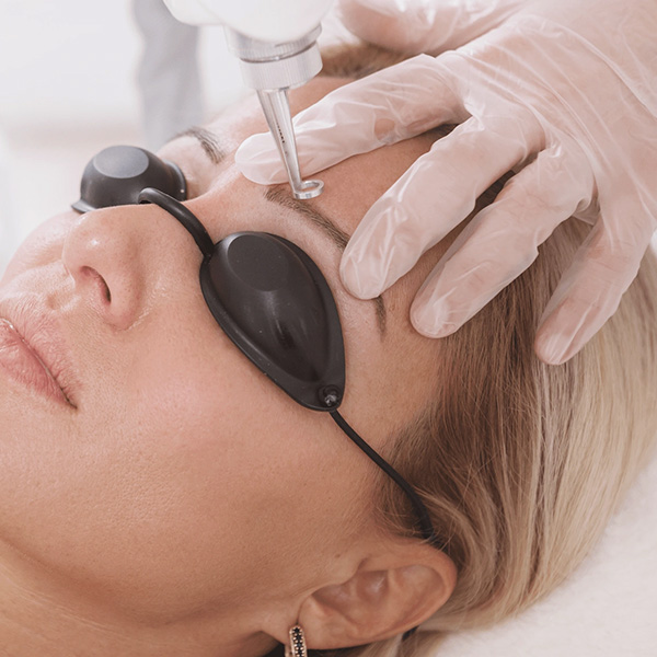 pmu entfernung Permanent Make Up Enfernung mit Pico-Laser in Zofingen