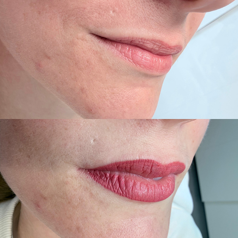 lippen vorher nachher Permanent Make Up Lippen: Vorher-Nachher, 2 Sitzungen